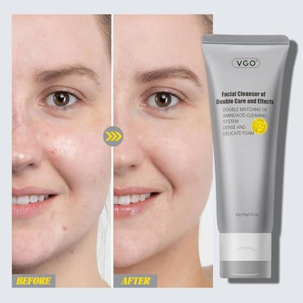 VGO Face Cleanser, Face Wash of Double Care and Effects, Cleansing Mud Mask & Amino Acid Cleansing Double Tube in 1 Facial Cleanser for All Skin Types (100g)