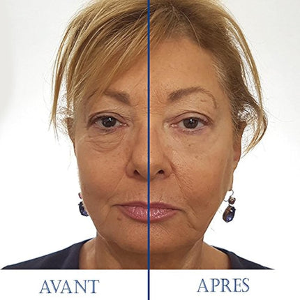 SKINEANCE - Magic Serum - Eye contour tensing effect - Smoothes fine lines and wrinkles - Reduces puffiness under the eyes - Acts in less than 3 minutes - Effective 8 to 10 hours - 5 tubes of 2 ml...