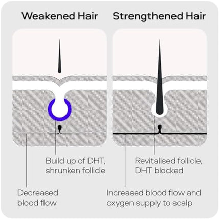 Sons Hair Growth Shampoo For Men. DHT Blocker. Thickening Formula Promotes Strong & Thick Regrowth. Contains Saw Palmetto, Argan Oil, Caffeine, & Rosemary. 3 Month Supply. Made in Europe.