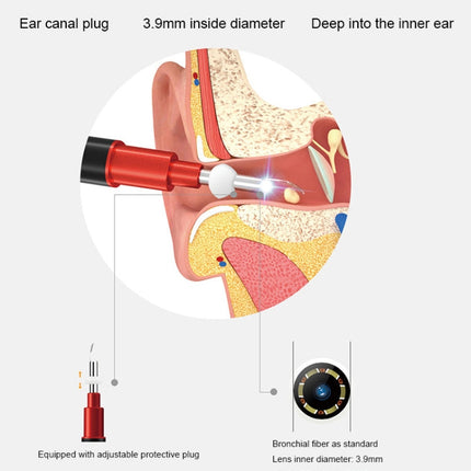 Bebird B1 Intelligent HD Visual Ear Cleaner Earwax Tool, Standard Version(Black)